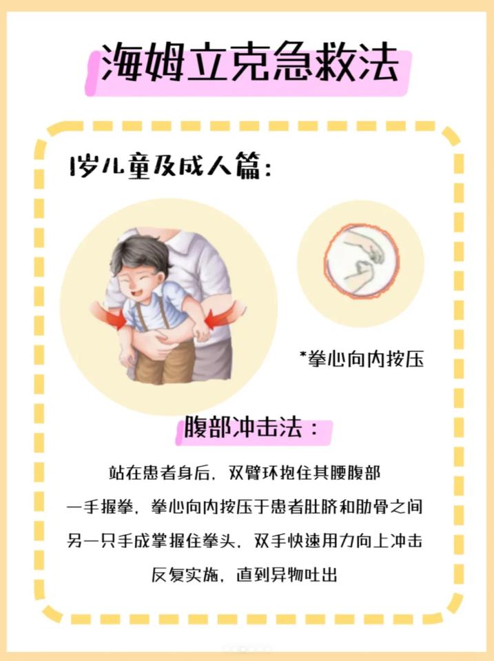 海姆立克急救法，每个家庭要学黄金20秒