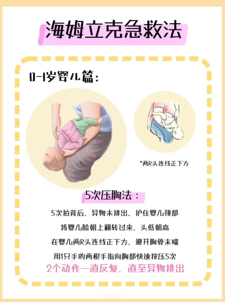 海姆立克急救法，每个家庭要学黄金20秒