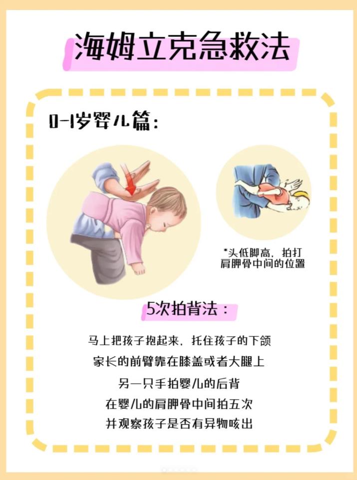 海姆立克急救法，每个家庭要学黄金20秒